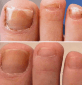  FungaBeam Customer Reviews