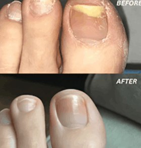  FungaBeam Customer Reviews